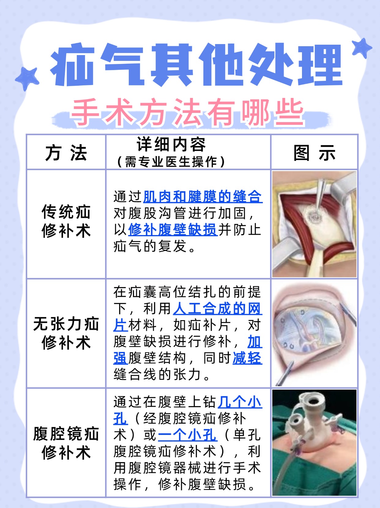 疝气最新疗法